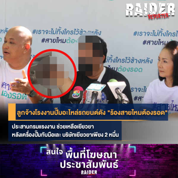 "ลูกจ้างโรงงานปั๊มอะไหล่รถยนต์ดัง" ร้อง "สายไหมต้องรอด" ประสานกรมแรงงาน ช่วยเหลือเยียวยา หลังเครื่องปั๊มทับมือเละ บริษัทเยียวยาเพียง 2 หมื่น 218 Raider-Reporter.com ข่าวไรเดอร์รีพอร์ตเตอร์ เกาะติดข่าวล่าสุด ทุกเหตุการณ์ ข่าวสังคมการเมือง ข่าวอาชญากรรม ข่าวด่วนวันนี้ Raider-Reporter.com ข่าวไรเดอร์รีพอร์ตเตอร์ เกาะติดข่าวล่าสุด ทุกเหตุการณ์ ข่าวสังคมการเมือง ข่าวอาชญากรรม ข่าวด่วนวันนี้